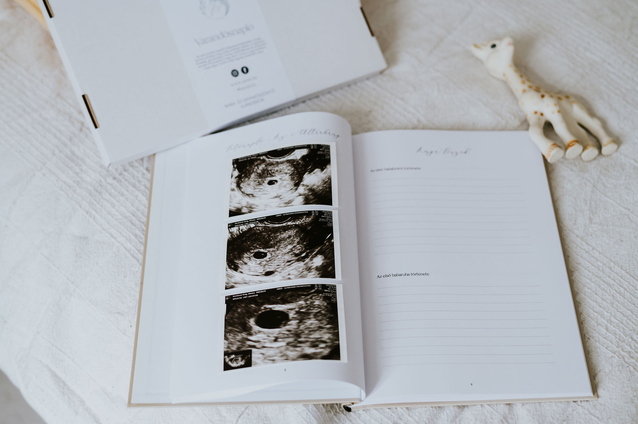 niMin várandós kismama napló, az első 9 hónap kinyitva, benne egy ultrahang kép és mellette egy zsiráfos baba rágóka